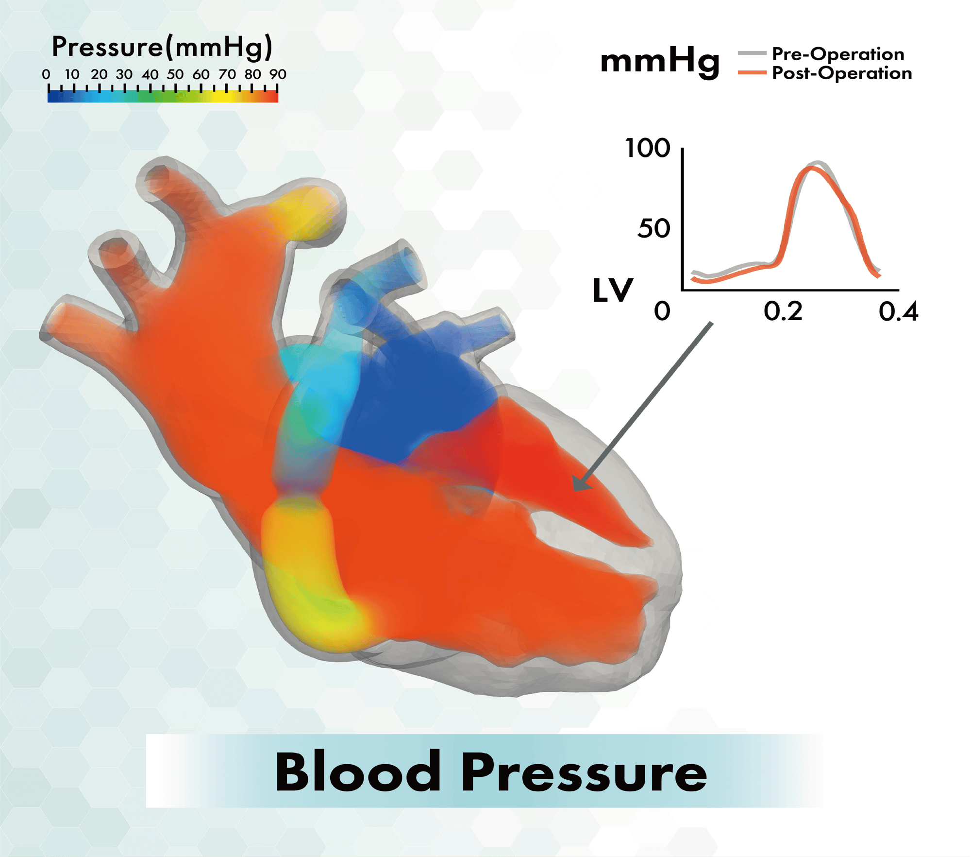 ped UT-Heart