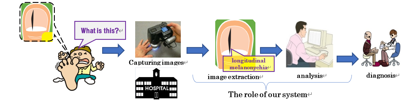 melanoma examination